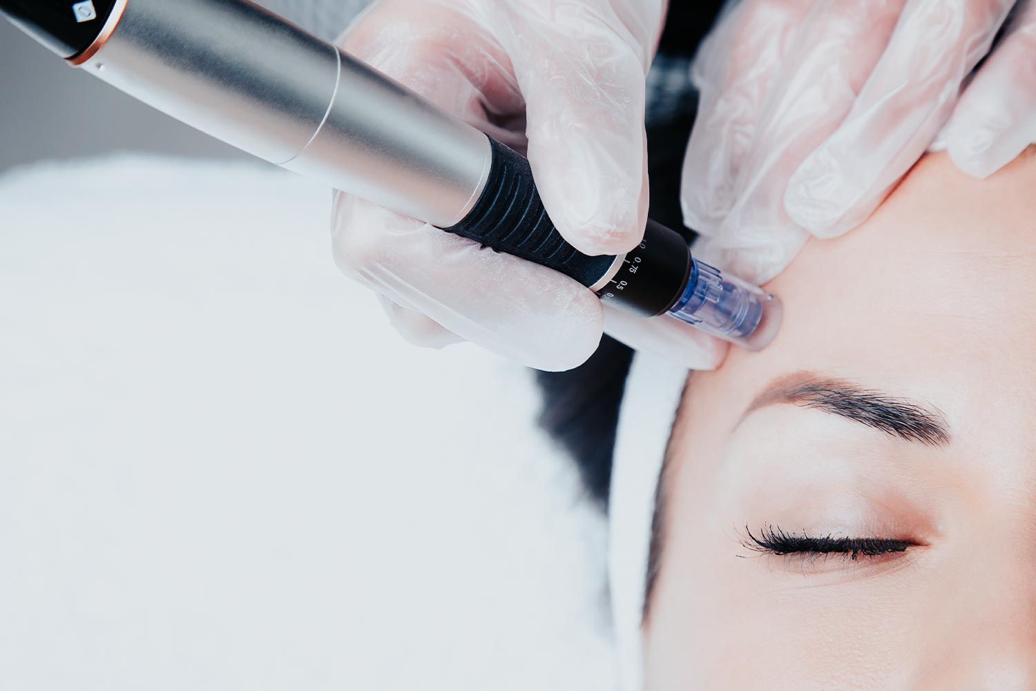 MESOTHERAPIE KÖLN
